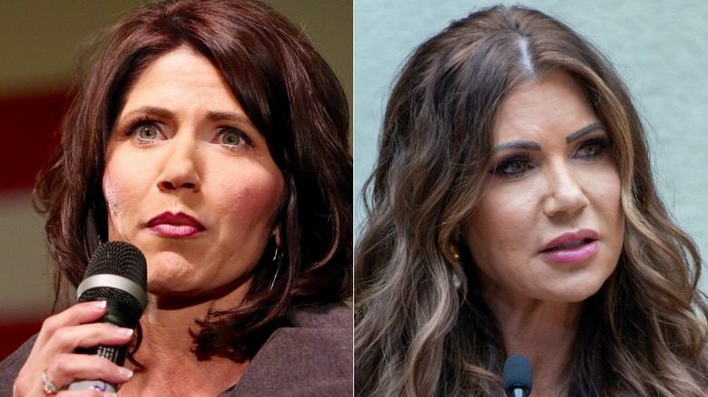 Kristi Noem avant vs après les charges de lèvres