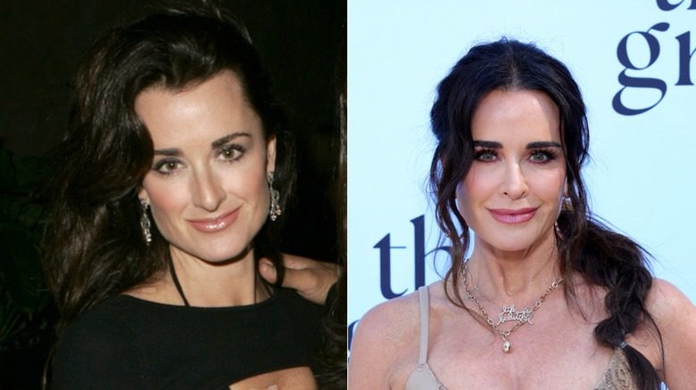 Kyle Richards avec les cheveux noirs ondulés avant et après son travail de nez