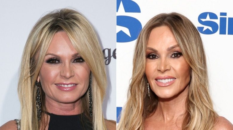 Tamra juge avant et après son lifting