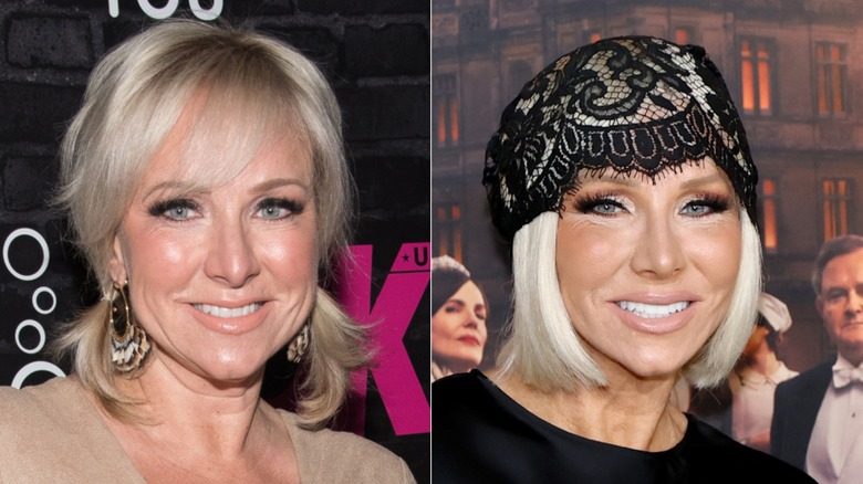 Margaret Josephs de Rhonj avant et après son lifting