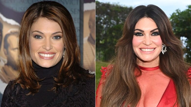 Une photo avant et après montrant la transformation du visage de Kimberly Guilfoyle