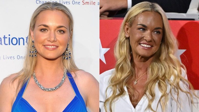 Vanessa Trump en 2010 et 2024