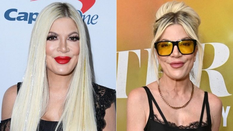 Photos côte à côte montrant la perte de poids du visage de Tori Spelling