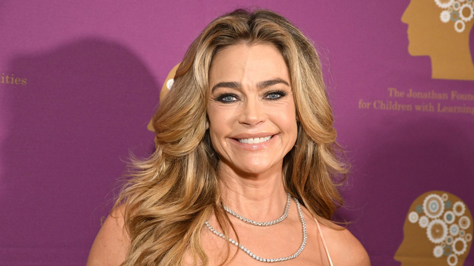 Les photos avant et après du lifting de Denise Richards sont absolument sauvages