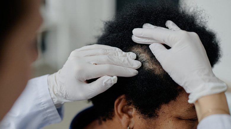 Médecin examinant les cheveux et le cuir chevelu d'une femme