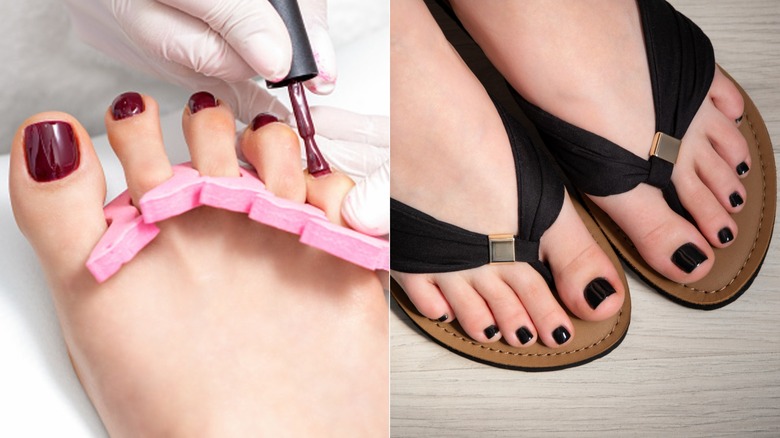 Pieds aux ongles bordeaux et aux ongles noirs