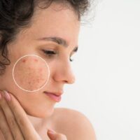Combien de temps faut-il réellement pour réparer une barrière cutanée endommagée