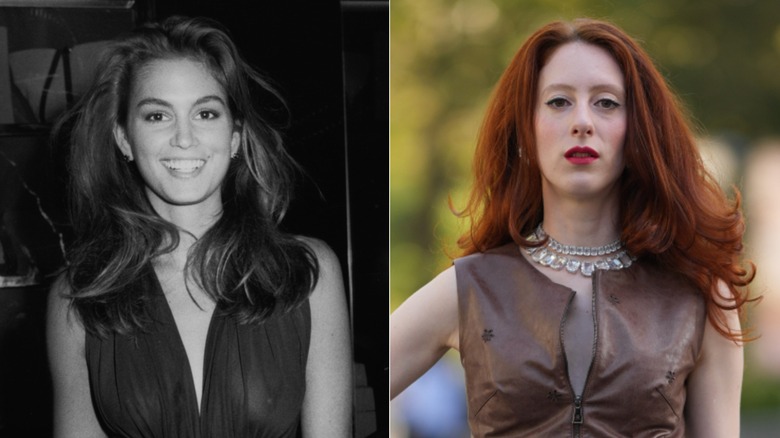 L : Cindy Crawford avec une éruption rebondissante dans les années 80. R : Une femme avec une éruption rebondissante en 2026